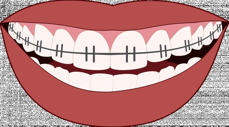 Dokter Orthodontist vs Salon Gigi: Gigi Sehat atau Demi Trend?